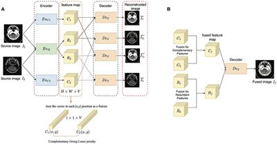 A Disentangled Representation Based Brain Image Fusion via Group Lasso Penalty